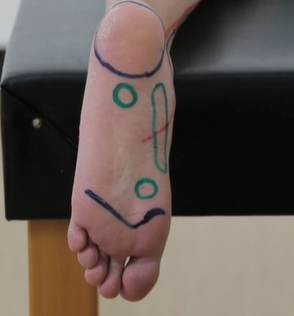 足底筋膜按摩圖